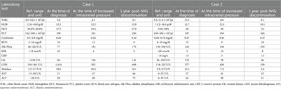 Case Report: IVIG causing bilateral papilledema and increased intracranial hypertension in patients with anti-TIF-1γ antibody-positive JDM